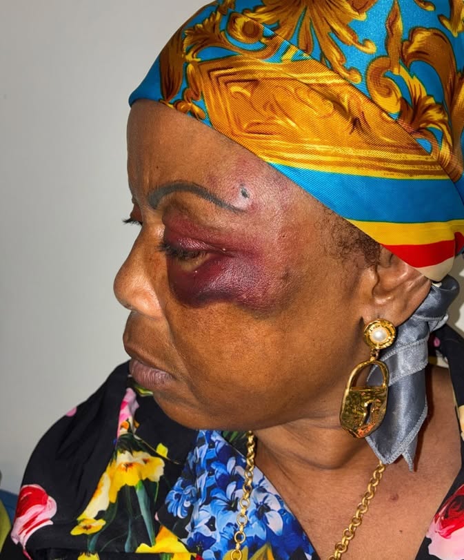 La mère de famille a eu trois côtes cassées, des hématomes au visage et souffre d'une incapacité de travail de deux semaines minimum...
